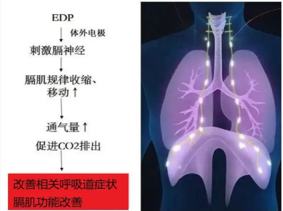 lALPD3Ir5N49WajNAaPNAjI_562_419.png